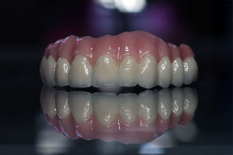 Zirconia Implants
