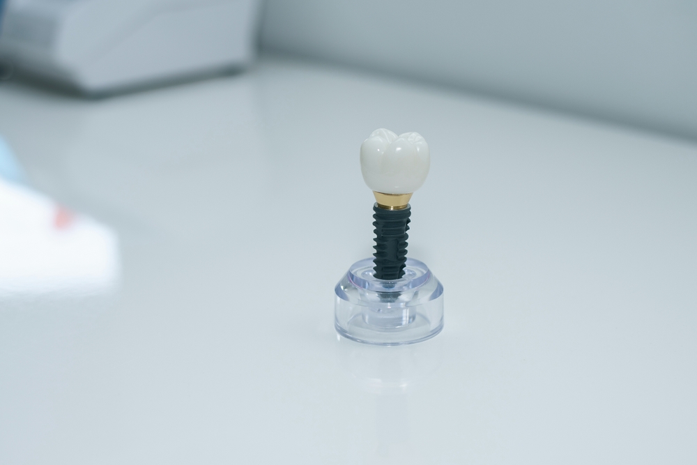 Dr. Montoya discussing dental implant options with a patient in a modern clinic